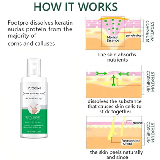 Corn Removal Spray 120ml – Pack of 2