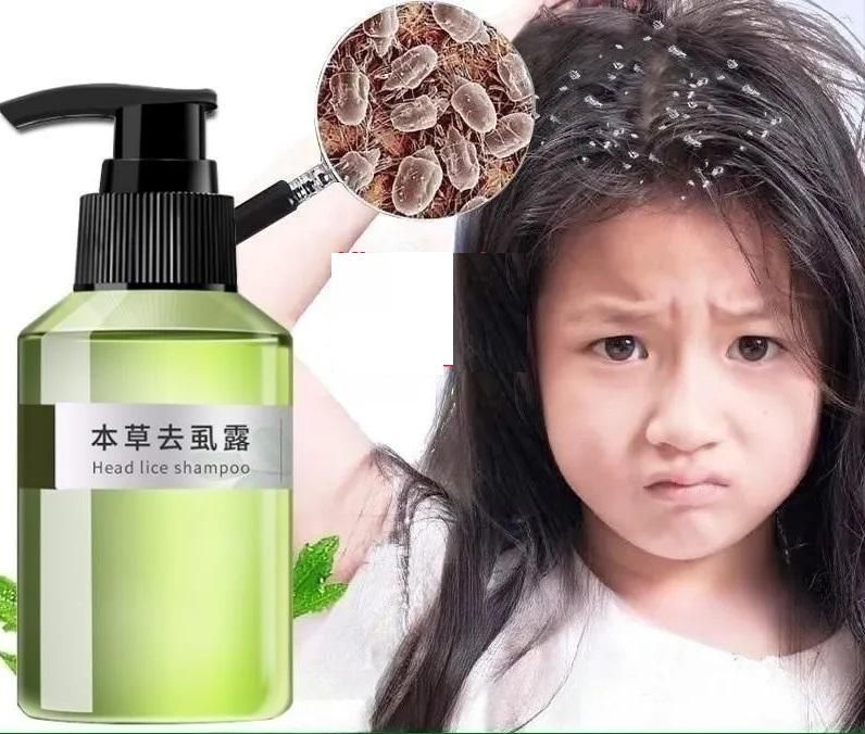 FairDealWorldShop Plant Anti-Lice Treatment Shampoo