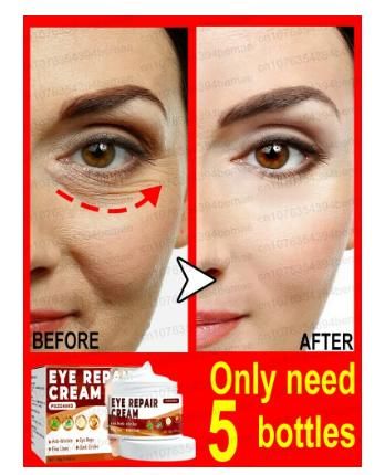 Eye Repair Cream – Pack of 2